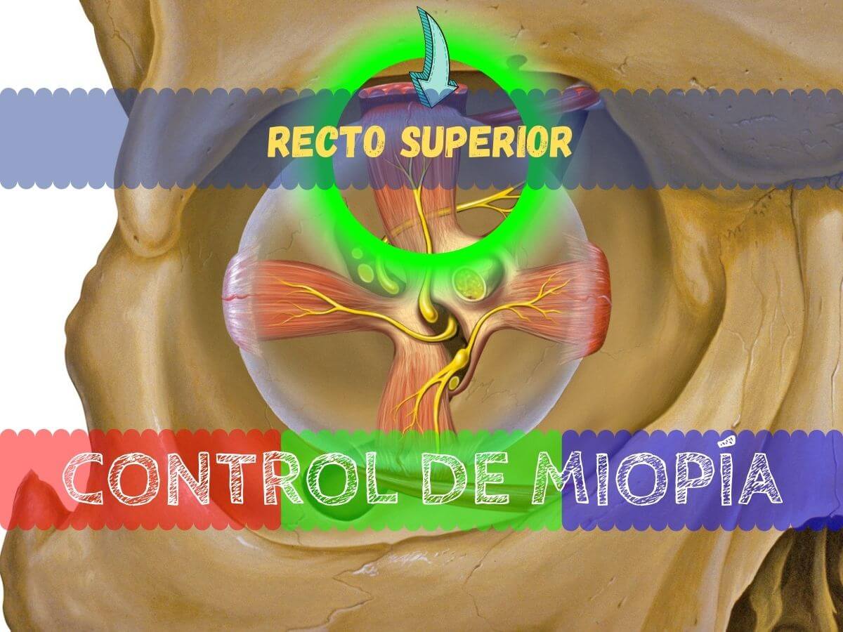 recto superior del ojo