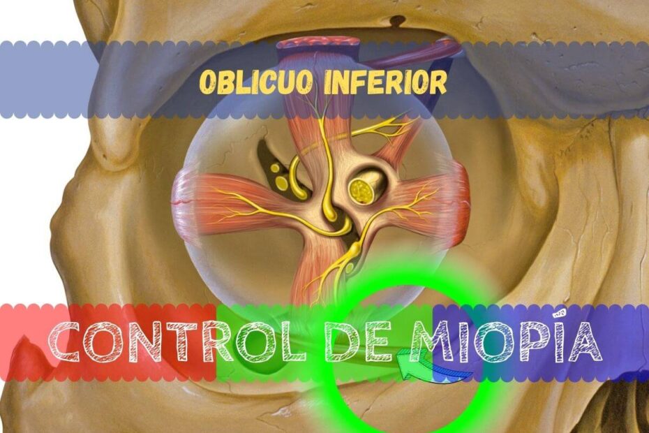 Banner - oblicuo inferior