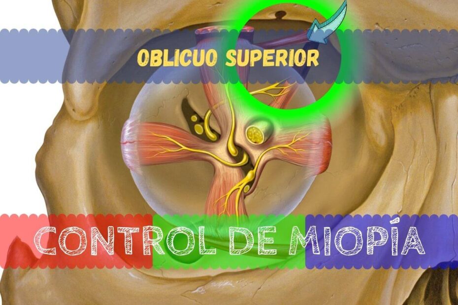 Banner - oblicuo superior