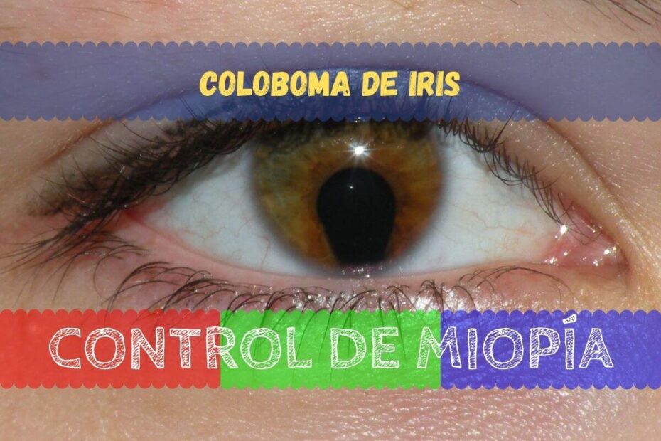 Banner - Coloboma de Iris