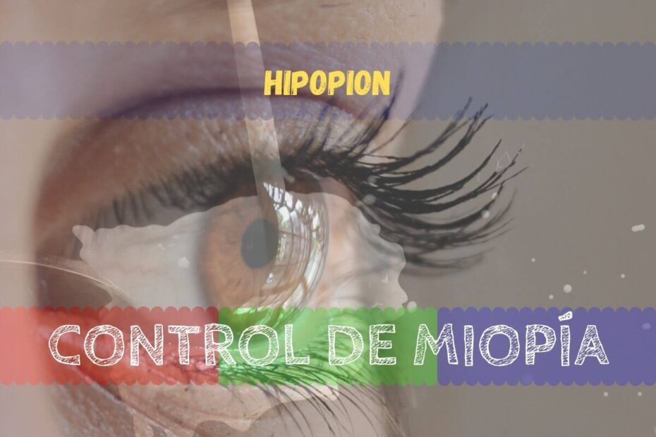Banner - Hipopion