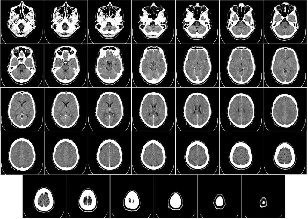 La imagen médica es un ejemplo de aplicación de algoritmos en la visión artificial