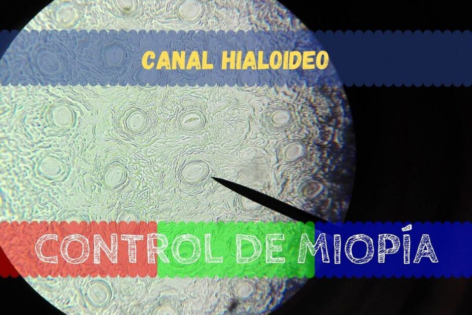 Banner - Canal Hialoideo