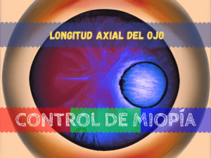 Imagen generada para el artículo del blog control de miopía