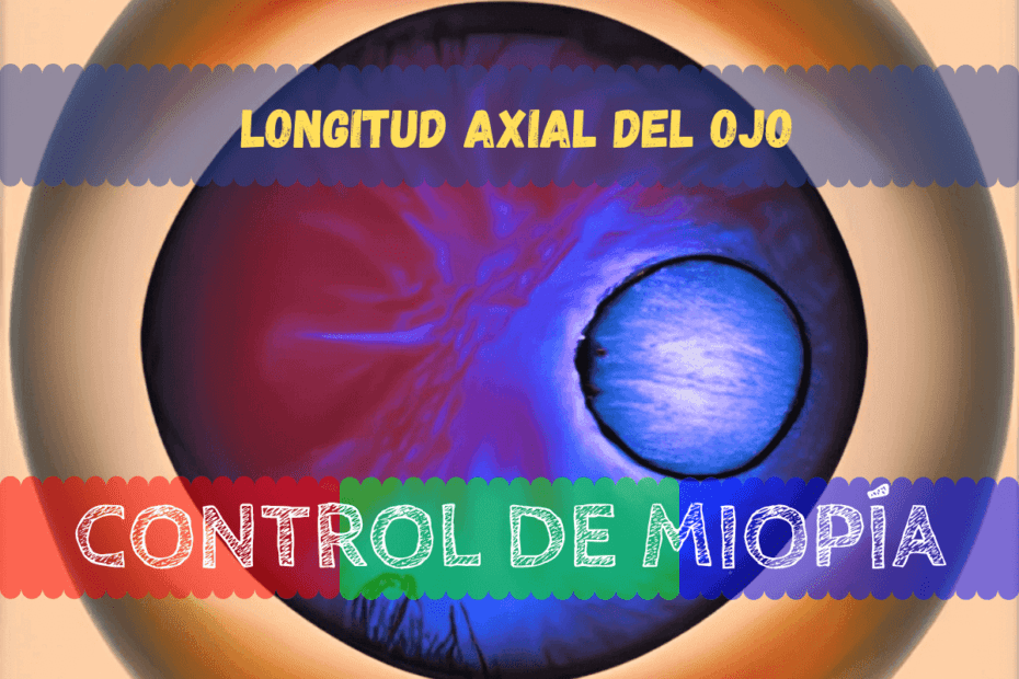 La importancia de medir la Longitud axial del ojo 1 Imagen generada para el artículo del blog control de miopía